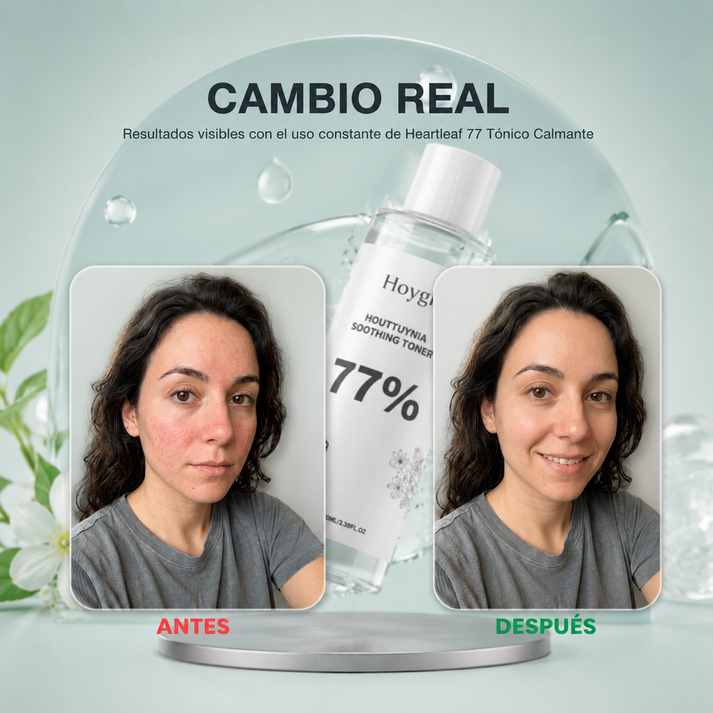 Tónico Facial Calmante de Houttuynia 77%