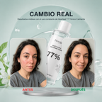 Tónico Facial Calmante de Houttuynia 77%