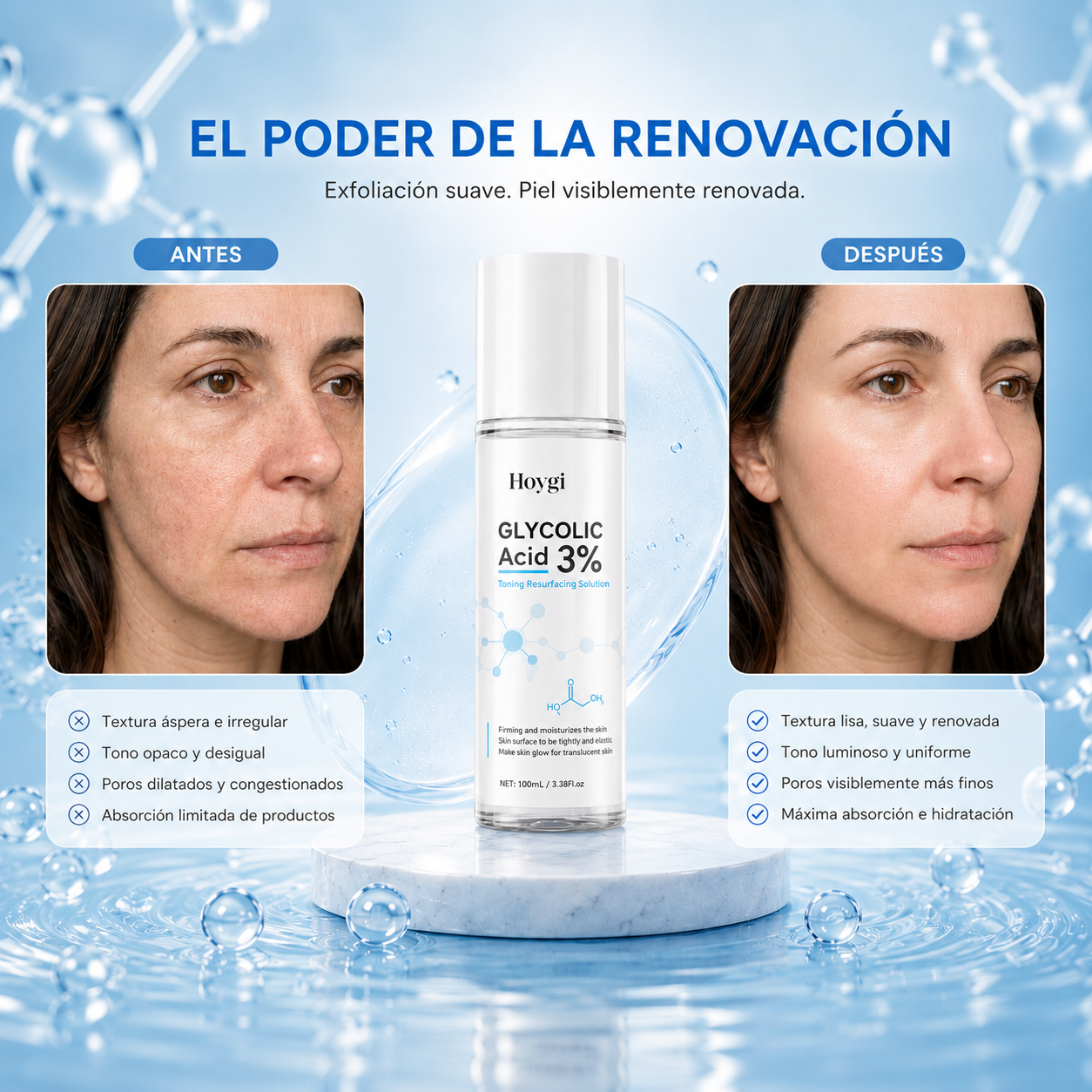 Tónica Renovadora con Ácido Glicólico 3%